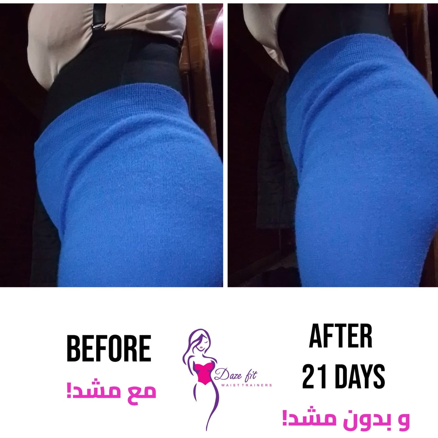 Shapewear shorts with removable straps